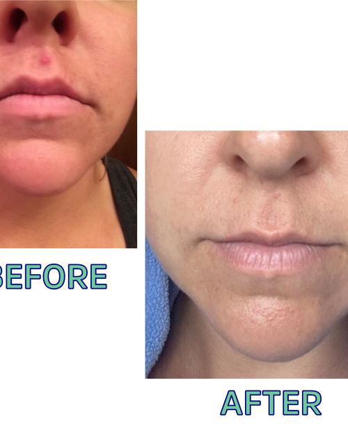 Load image into Gallery viewer, Cleansing Oil For Normal/Combo Skin 4 Oz by FATCO Skincare Products
