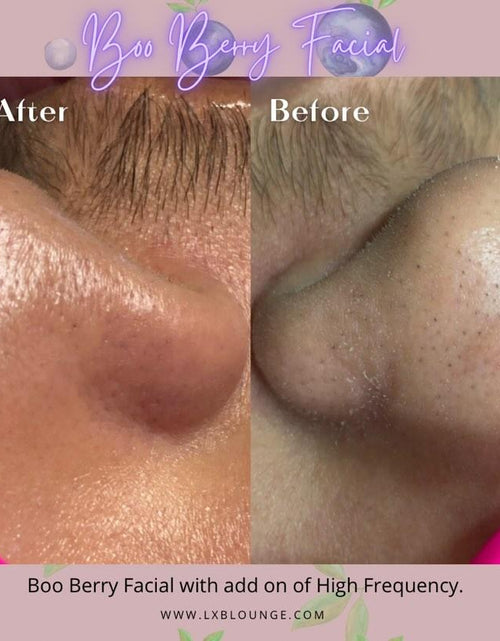 Load image into Gallery viewer, ZAQ Nova Powerful Ultrasonic Scrub Spatula by ZAQ Skin &amp; Body
