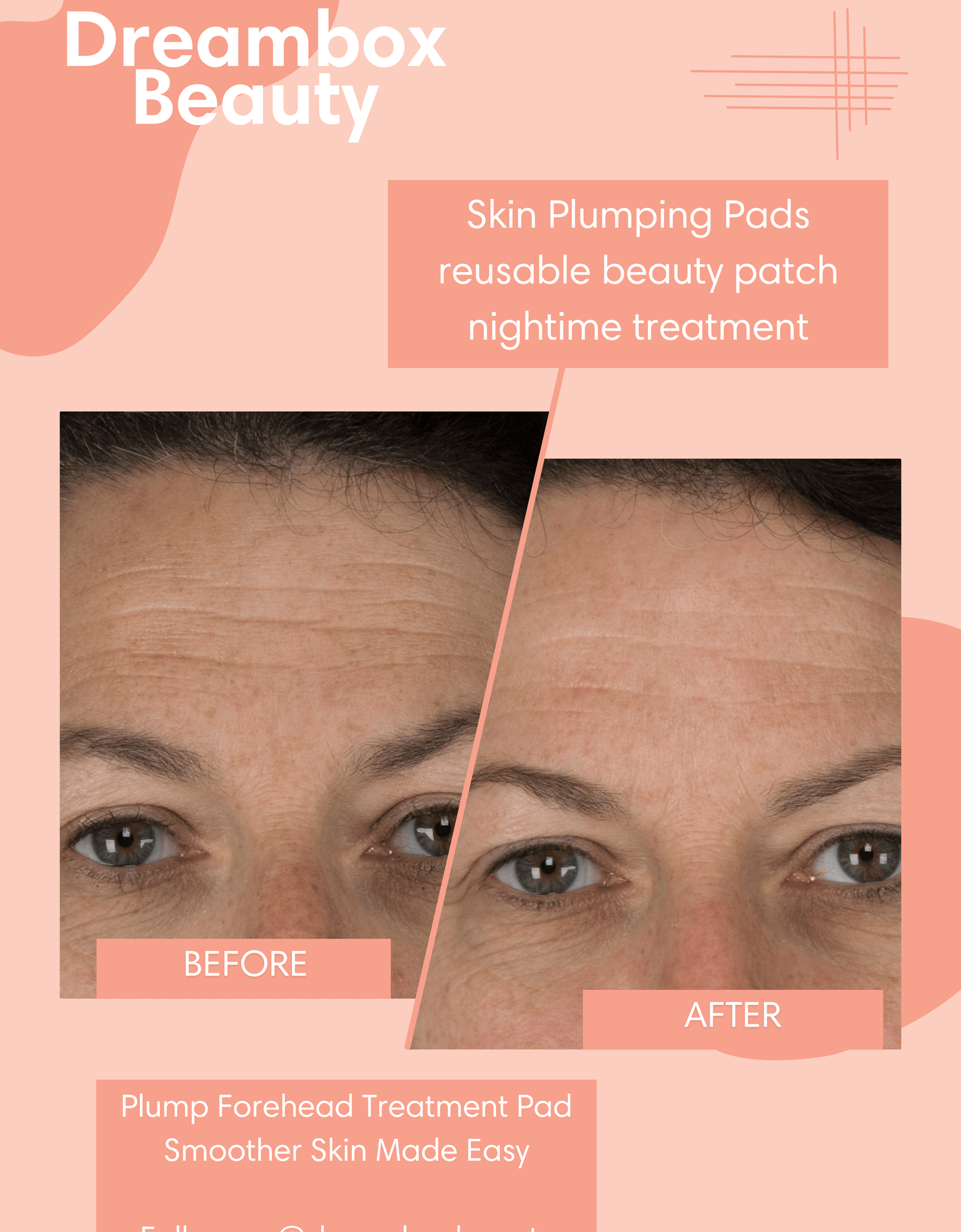 Skin Plumping Forehead Mask [Reusable] by Dreambox Beauty