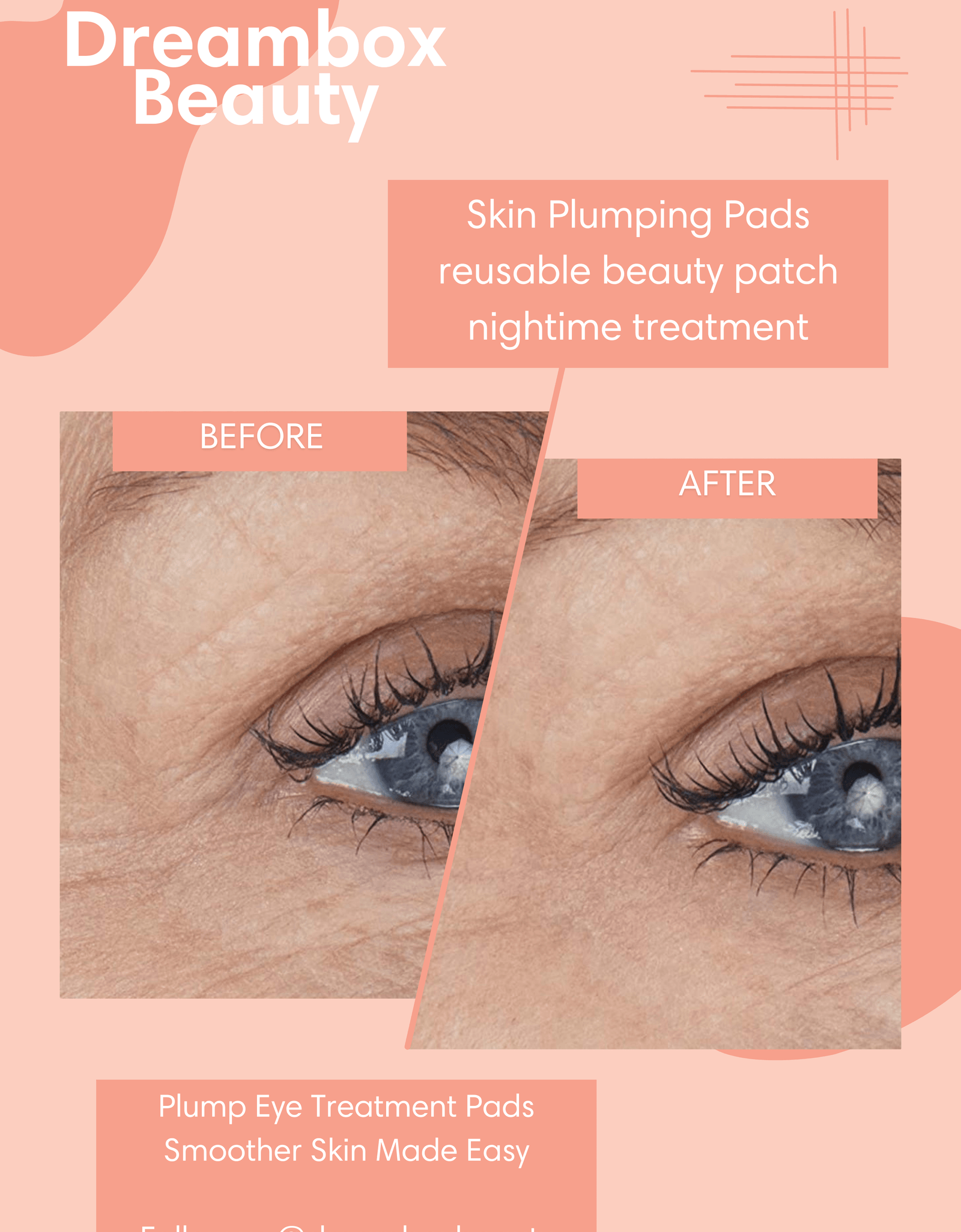 Skin Plumping Under Eye Mask [Reusable] by Dreambox Beauty