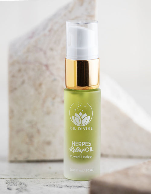 Load image into Gallery viewer, Fever Blisters Relief Oil by Oil Divine
