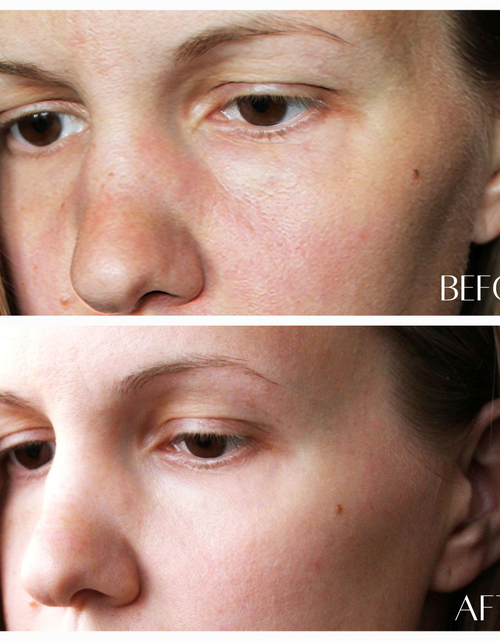 Load image into Gallery viewer, No. 2 REFRESH - Orchid Stem Cell &amp; Vitamin C Essence by Botanicary Skincare
