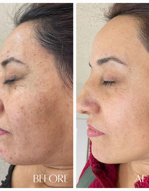 Load image into Gallery viewer, No. 3 RESURFACE - AHA &amp; Enzyme Brightening Nectar by Botanicary Skincare
