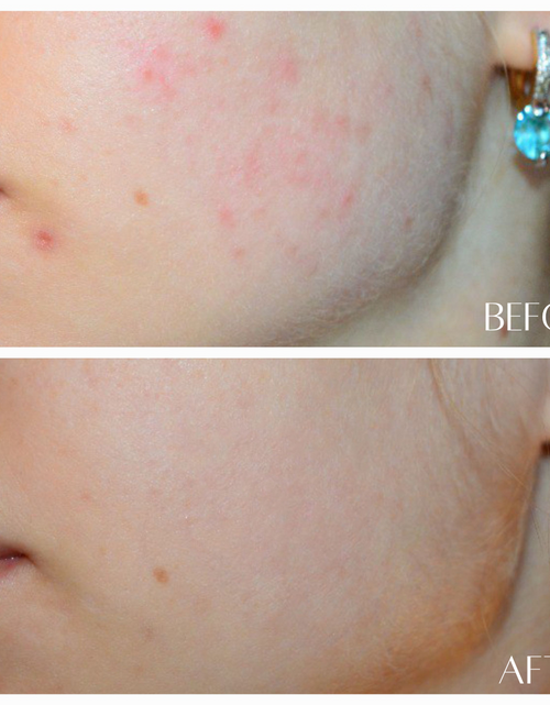 Load image into Gallery viewer, No. 5 RECOVER - HydroFlora Balancing Mist by Botanicary Skincare
