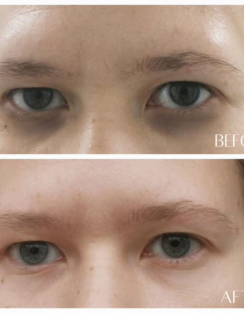 Load image into Gallery viewer, No. 8 REAWAKEN - 24k Gold Illuminating Eye Elixir by Botanicary Skincare

