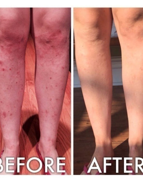 Load image into Gallery viewer, Derm #1 Dry Skin Rescue with Vitamin B3 3.38 oz by Best Clean Beauty
