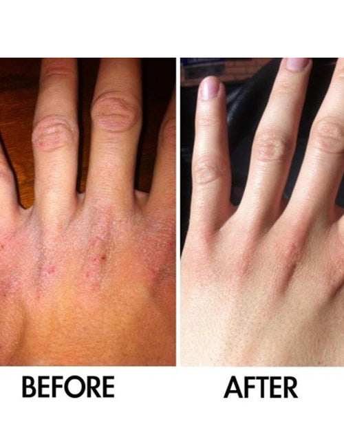 Load image into Gallery viewer, SkinSanity® Intensive Body Lotion - 5% Niacinamide helps with Eczema 3.38 fl oz by Best Clean Beauty
