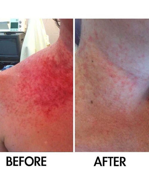 Load image into Gallery viewer, Derm #1 Dry Skin Rescue with Vitamin B3 3.38 oz by Best Clean Beauty
