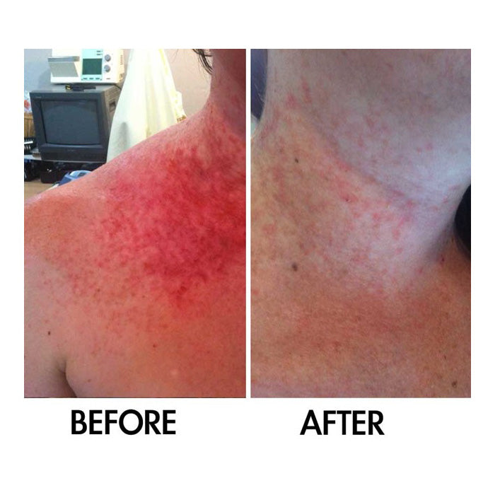 Derm #1 Dry Skin Rescue with Vitamin B3 3.38 oz by Best Clean Beauty