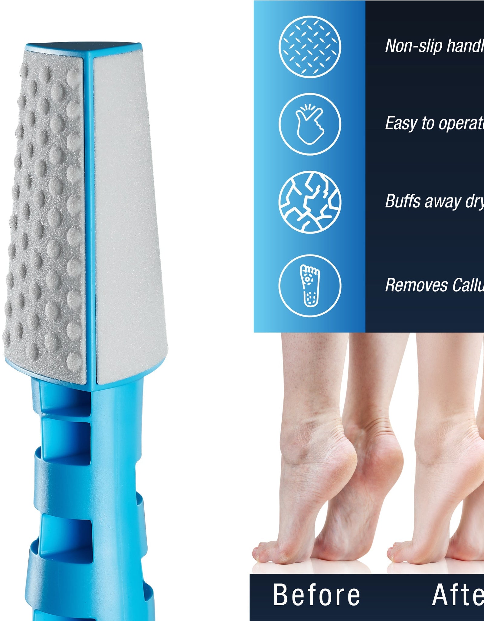 3 In 1 Callus Remover by Pursonic