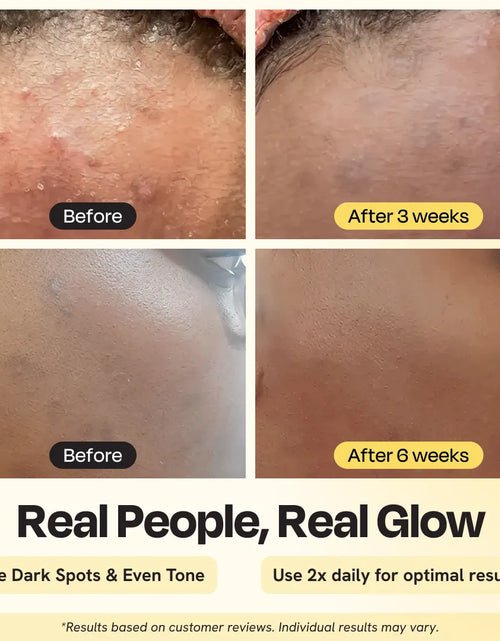 Load image into Gallery viewer, Advanced Brightening Moisturizer
