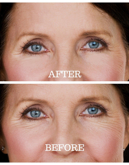 Load image into Gallery viewer, Skin Plumping Under Eye Mask [Reusable] by Dreambox Beauty
