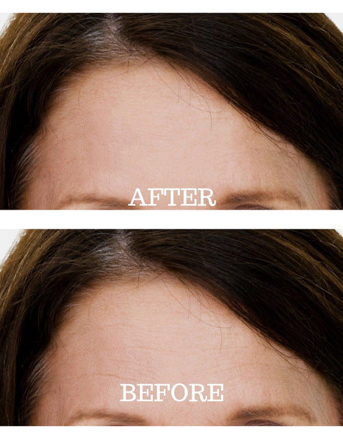 Load image into Gallery viewer, Skin Plumping Forehead Mask [Reusable] by Dreambox Beauty
