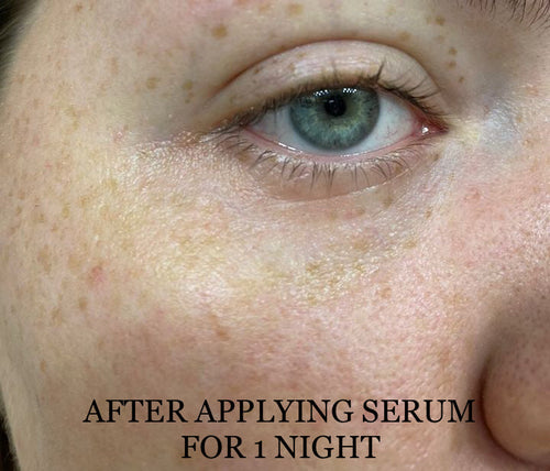 Load image into Gallery viewer, NEW Shwally Methylene Blue Daily Sunshine Serum + Copper Peptides Option by Shwally
