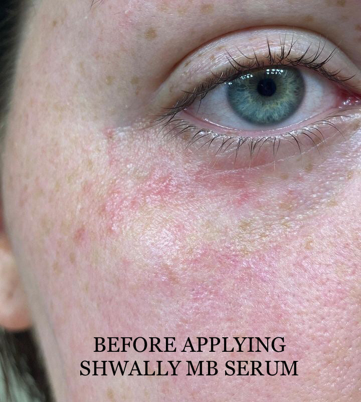 NEW Shwally Methylene Blue Daily Sunshine Serum + Copper Peptides Option by Shwally