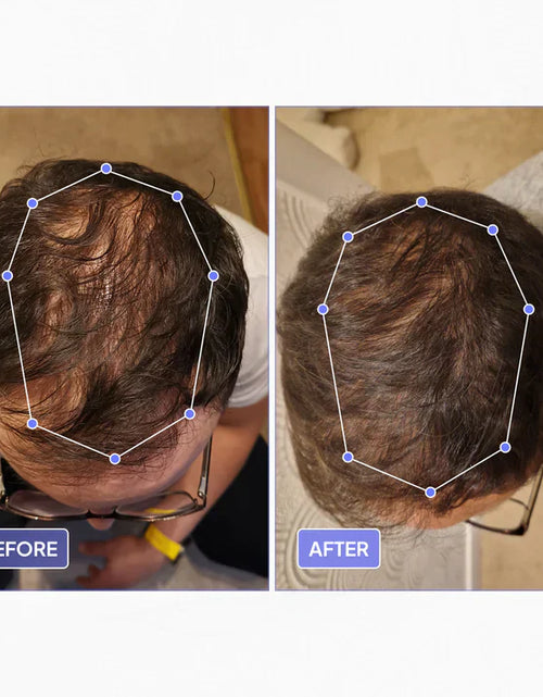 Load image into Gallery viewer, THINFIX® Hair Growth Routine by OBRO

