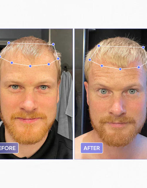 Load image into Gallery viewer, THINFIX® Hair Growth Routine by OBRO
