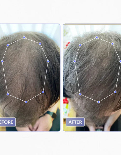 Load image into Gallery viewer, THINFIX® Hair Growth Routine by OBRO
