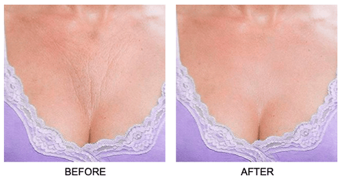 Load image into Gallery viewer, Skin Plumping Chest Mask [Reusable] by Dreambox Beauty
