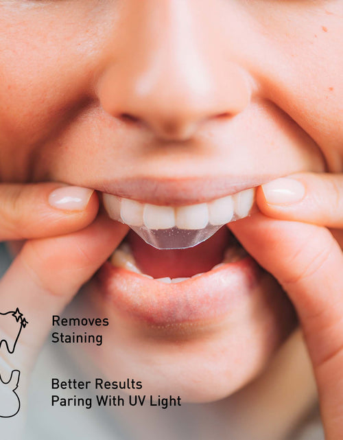 Load image into Gallery viewer, Pursonic Ultimate Teeth Whitening &amp; Oral Care Bundle – LED Whitening Kit, Whitening Strips, &amp; USB Electric Toothbrush by Pursonic
