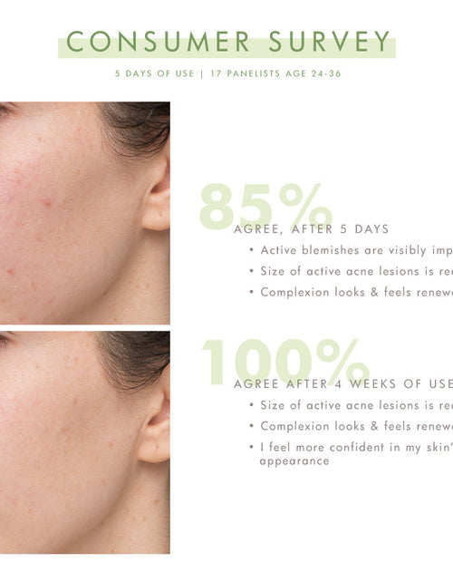 Load image into Gallery viewer, Comeback Clear™ by FarmHouse Fresh skincare
