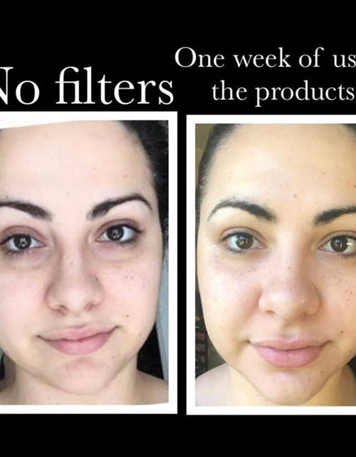 Load image into Gallery viewer, SkinSanity® Youth Restore Regimen by Best Clean Beauty
