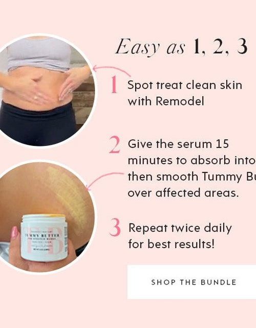 Load image into Gallery viewer, ReModel Serum: Stretch Mark Treatment by The Spoiled Mama
