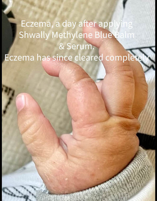Load image into Gallery viewer, NEW Shwally Tallow &amp; Methylene Blue Anti-Aging Face Cream by Shwally
