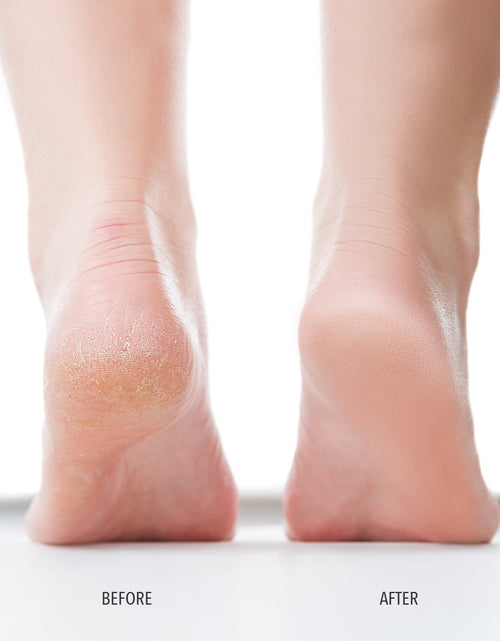 Load image into Gallery viewer, Foot Scrub by LONDONTOWN
