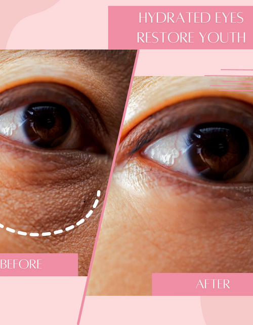 Load image into Gallery viewer, Hydrating Under Eye Mask [Reusable] by Dreambox Beauty
