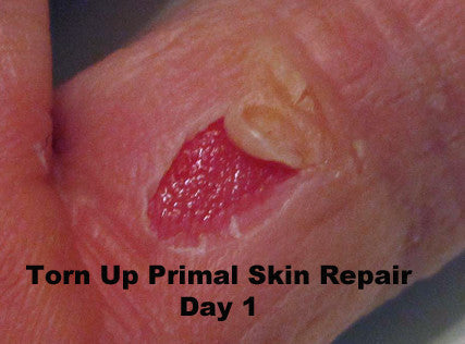 Load image into Gallery viewer, Torn Up Skin Repair by Primal Life Organics #1 Best Natural Dental Care
