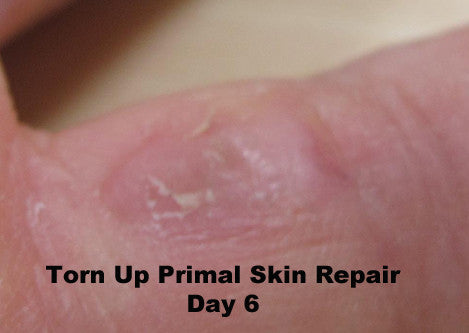 Load image into Gallery viewer, Torn Up Skin Repair by Primal Life Organics #1 Best Natural Dental Care
