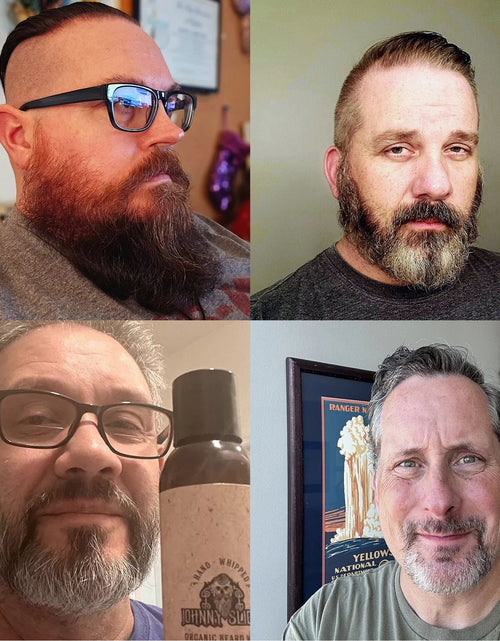 Load image into Gallery viewer, Thinning Hair Kit
